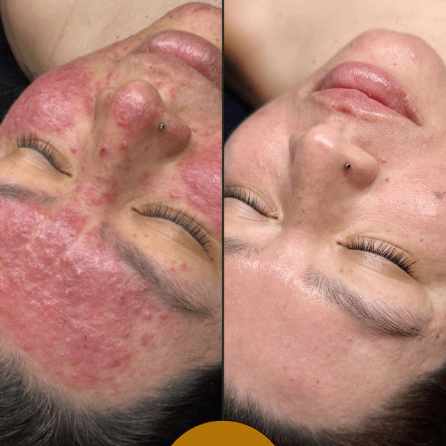 Skinvestment Club at Desert Rose Skincare in Rio Rancho, NM